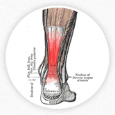 An image of a leg diagram