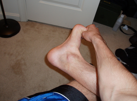 What are the Best Ways for a Runner to Prevent and Improve Plantar