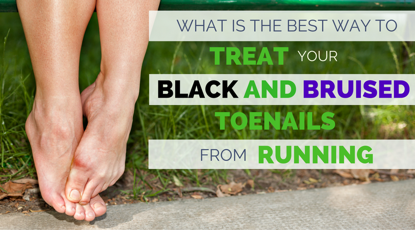 Bruised Toenail: Causes, Treatment, And How to Run Again  