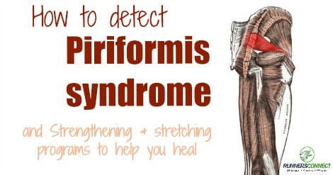 Piriformis syndrome FB