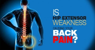 Is Hip Extensor Weakness Causing Your Back Pain? - Runners Connect