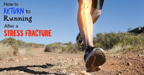 Bone Stimulators & How to Return to Running After a Stress