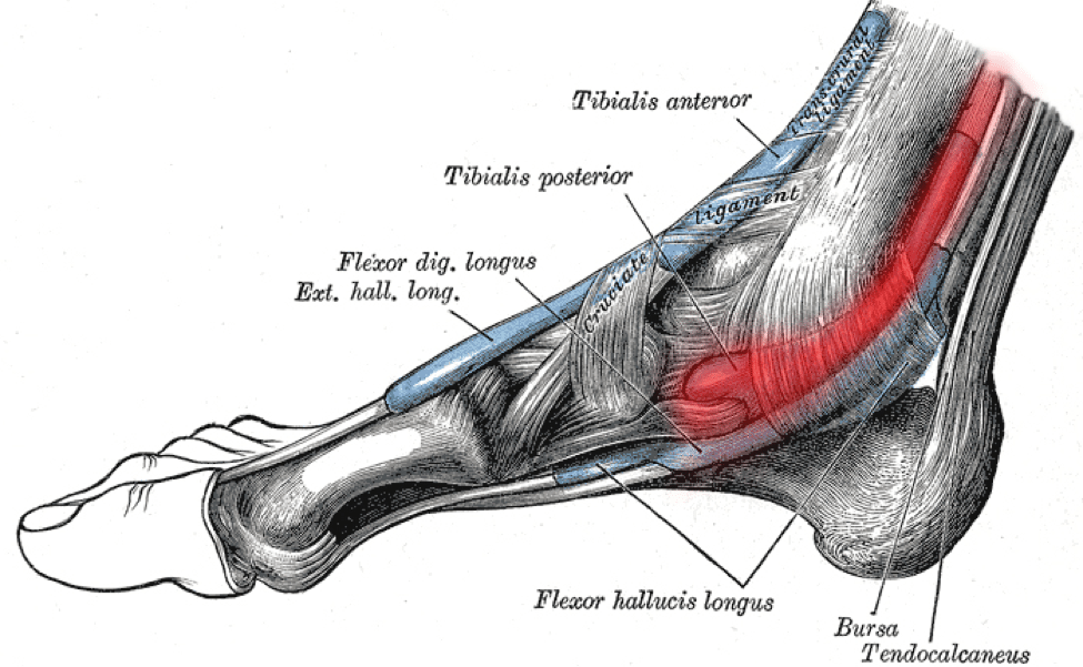 pain on inside of achilles tendon
