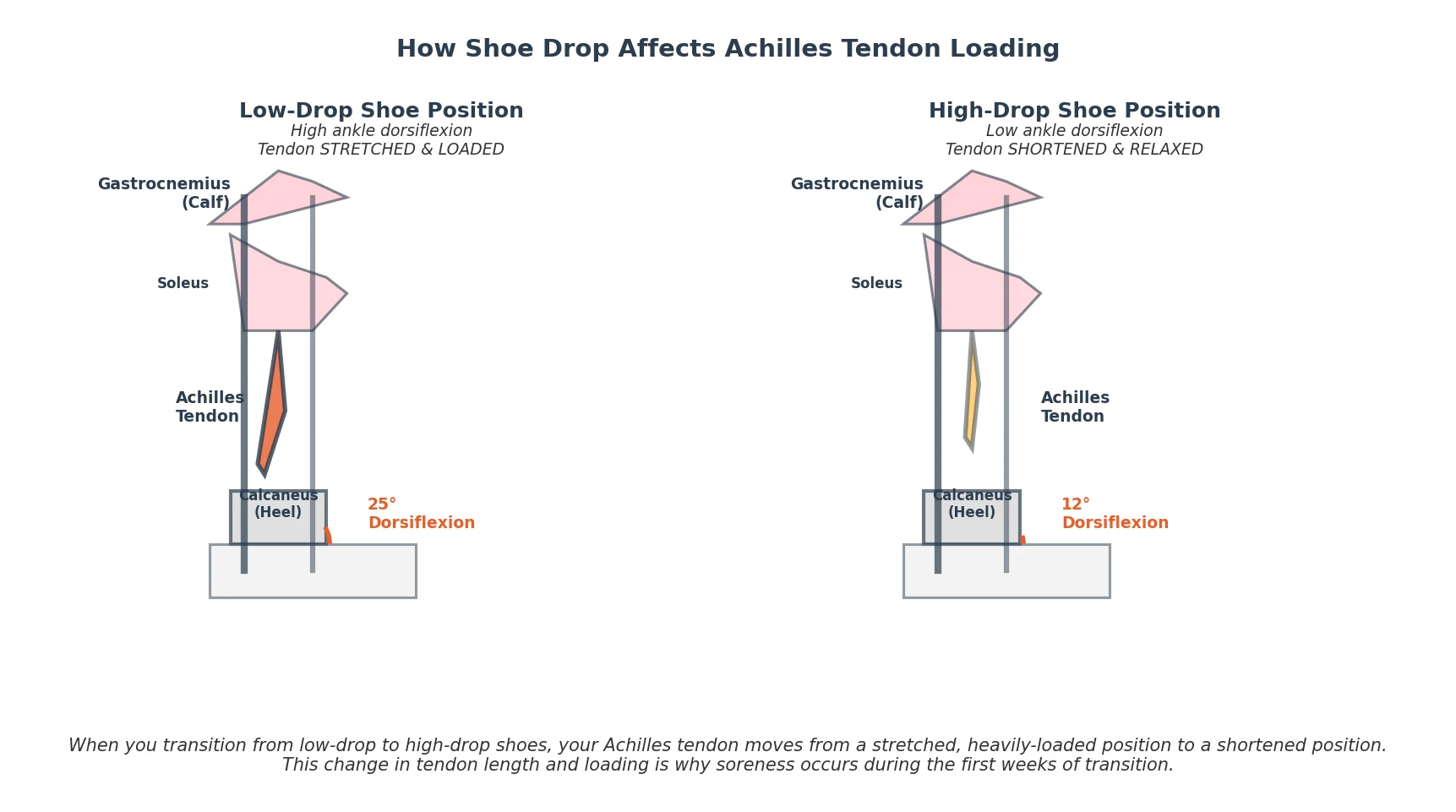 Anatomical comparison showing how shoe drop affects Achilles tendon length and loading in low-drop versus high-drop positions