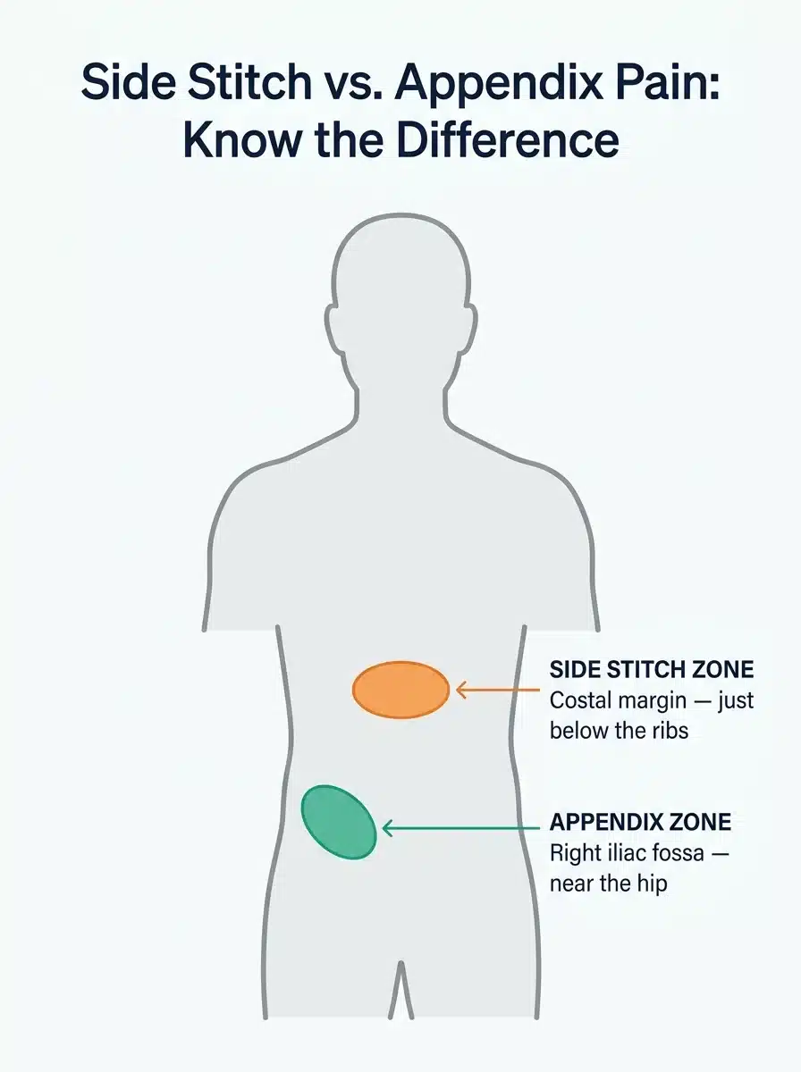 Diagram showing the difference between appendix pain location and side stitch location during running
